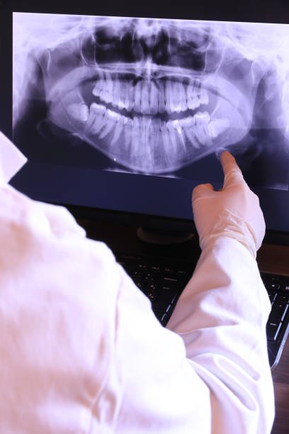 Best Emergency Root Canal Treatment in Meggett, SC
