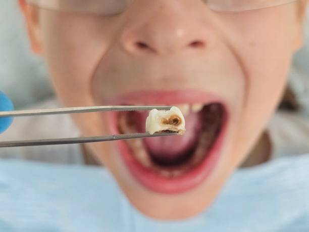 Best Mobile Emergency Dentist in Meggett, SC